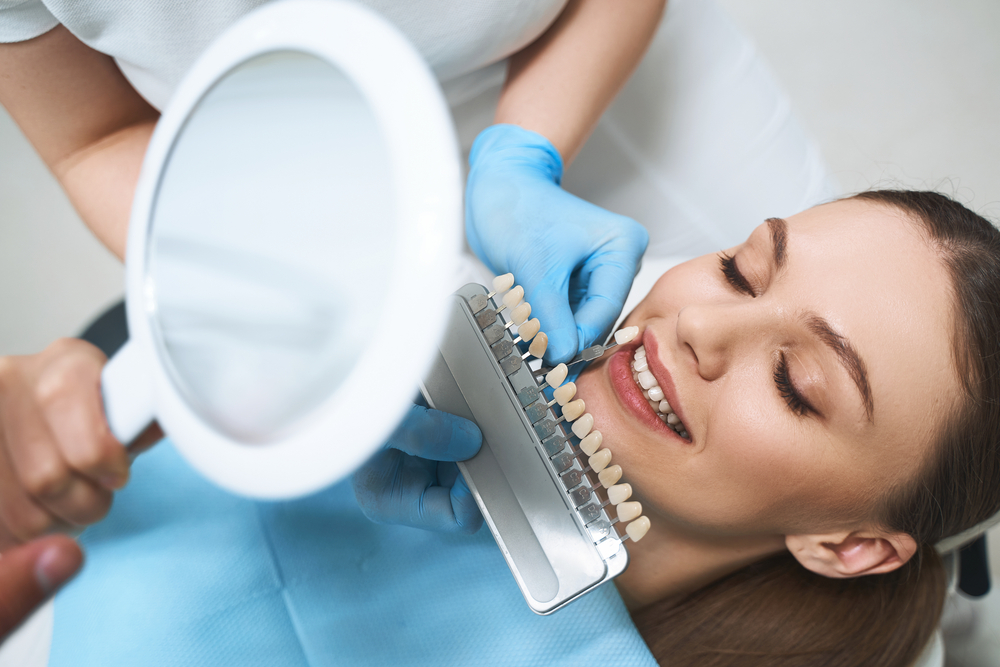 Porcelain veneer shade selection in San Marcos Dental professional comparing tooth shades with a patient during a porcelain veneer consultation in San Marcos