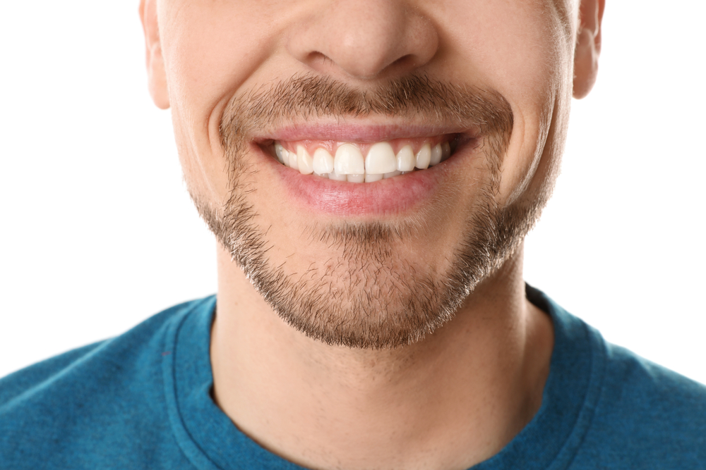 Close-up of a bright white smile Close-up of a man's bearded smile with bright white teeth