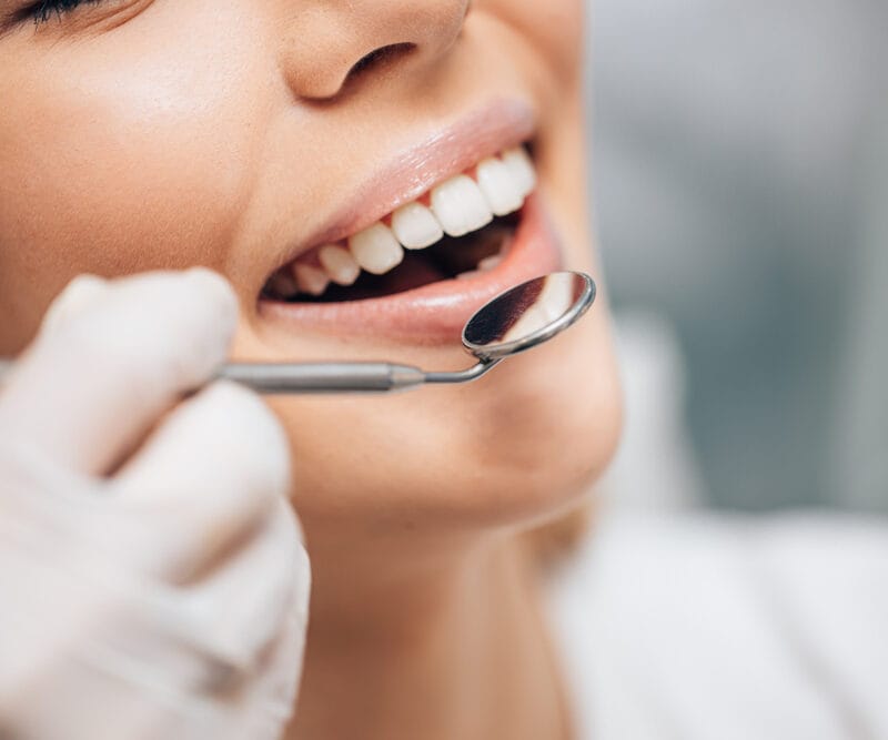 Close-up of a gloved hand holding a dental mirror near a patient's open smile
