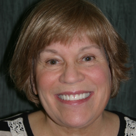 Smiling woman displaying her restored teeth after cosmetic dental care in the San Marcos and San Diego community