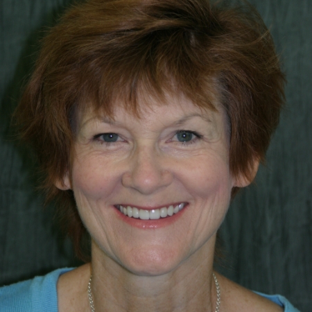 Tooth replacement care for a complete, natural-looking smile Smiling older woman showing a complete smile after tooth replacement care in the San Marcos and San Diego community