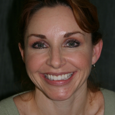 Restored smile after personalized dental treatment Smiling woman displaying a healthy smile after restorative dental care in the San Marcos and San Diego community