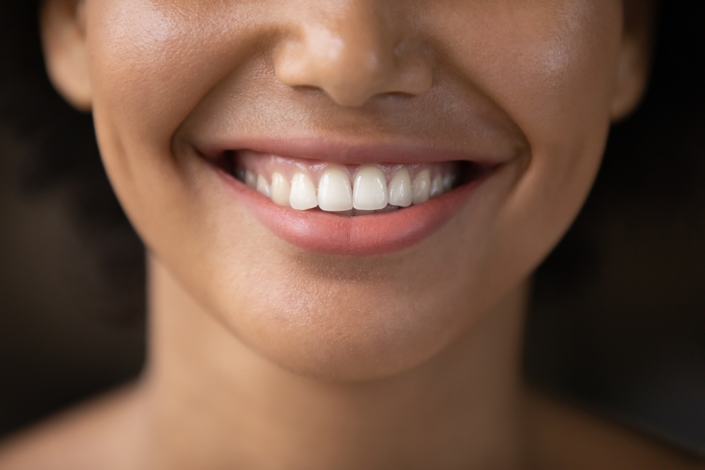 Close-up of teeth and gums Extreme close-up of a smile showing teeth and gum line