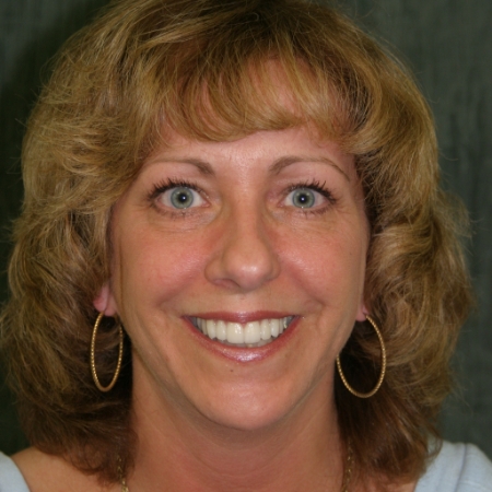 Natural-looking dental restoration and implant care Smiling woman showing a bright, natural-looking smile after dental restoration in the San Marcos and San Diego community