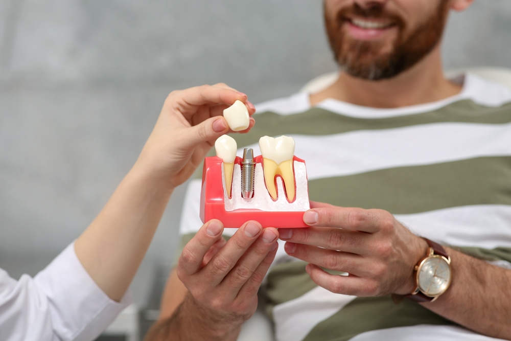 Dental implant model and tooth replacement consultation Dental professional explaining a dental implant model to a patient in the San Marcos and San Diego community