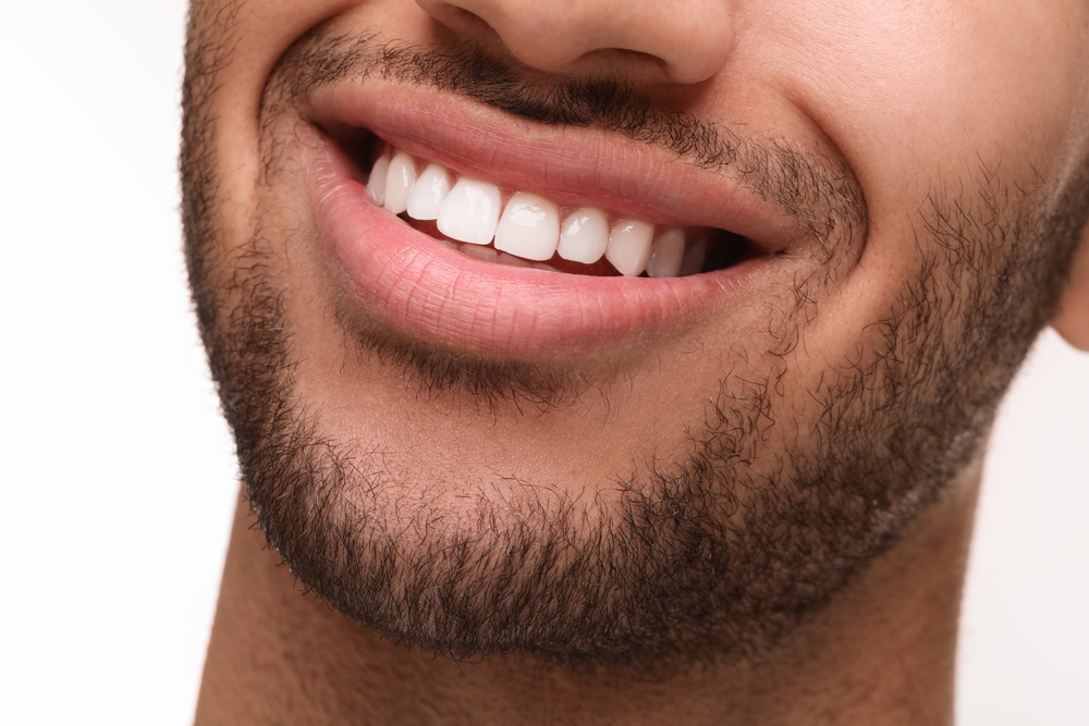 Close-up of a man’s bright, even smile representing cosmetic smile enhancement