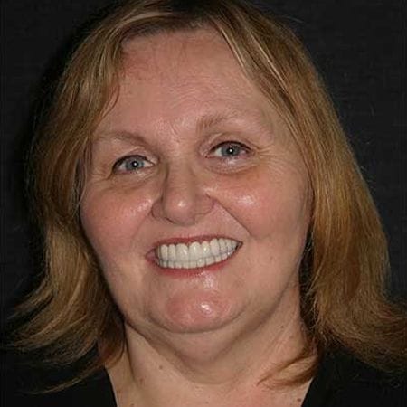 Smiling woman displaying a complete smile after comfortable dental care in the San Marcos and San Diego community