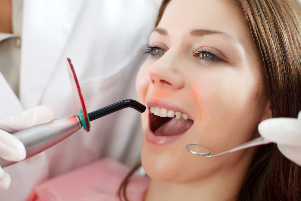 Curing composite resin during dental bonding Dentist using a curing light to harden tooth-colored resin during dental bonding treatment in San Marcos
